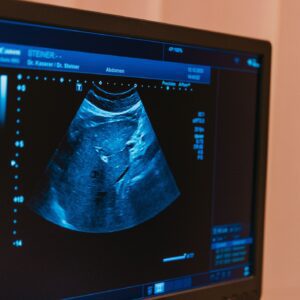Entdecken Sie den Herz-Ultraschall mit Dr. Klaus Steiner für präzise Herzdiagnostik auf unserer Website.